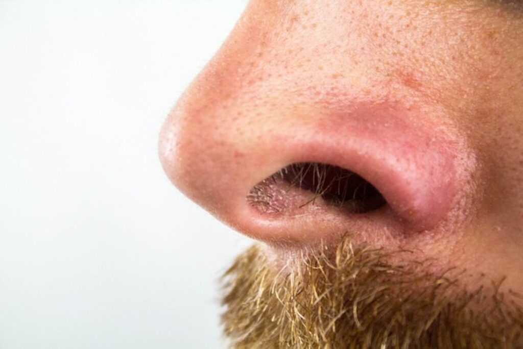 How To Get Rid Of Blackheads